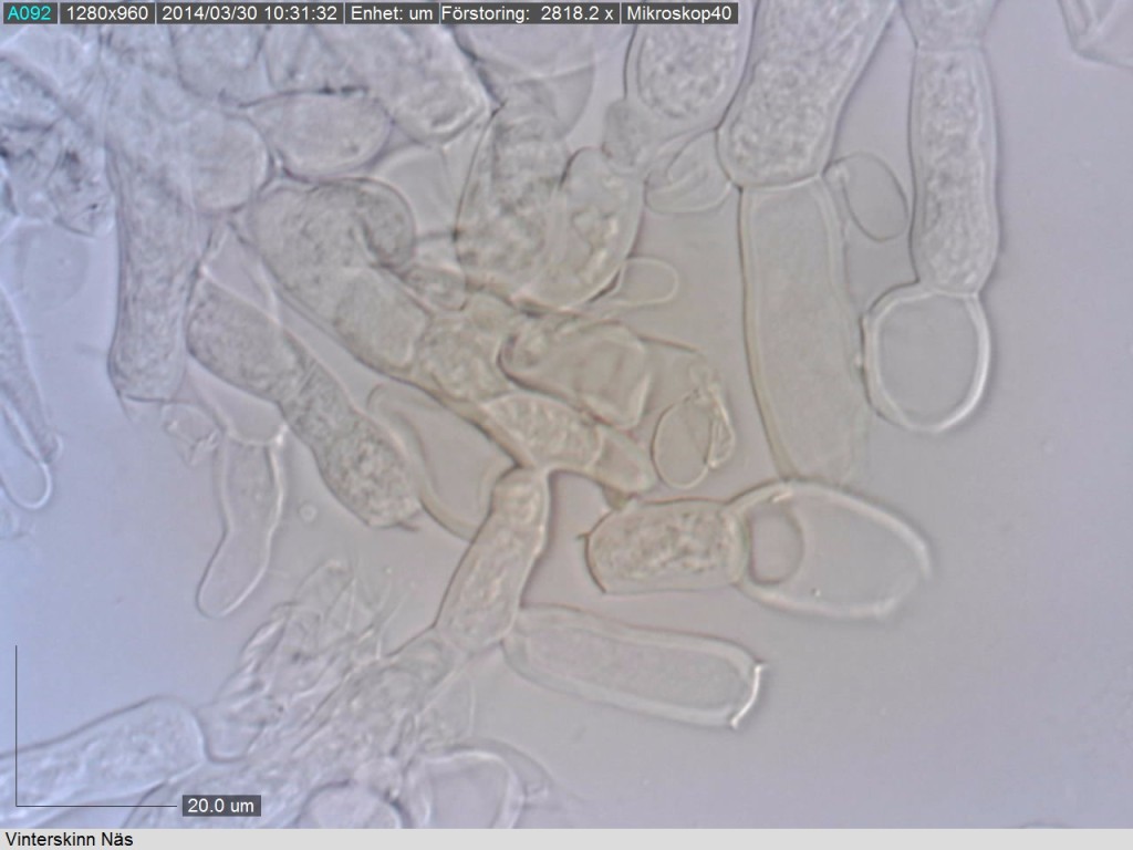 Hyfer med korta celler. Näs 29/3 2014 Mikroskopi: Lars Bsenko 