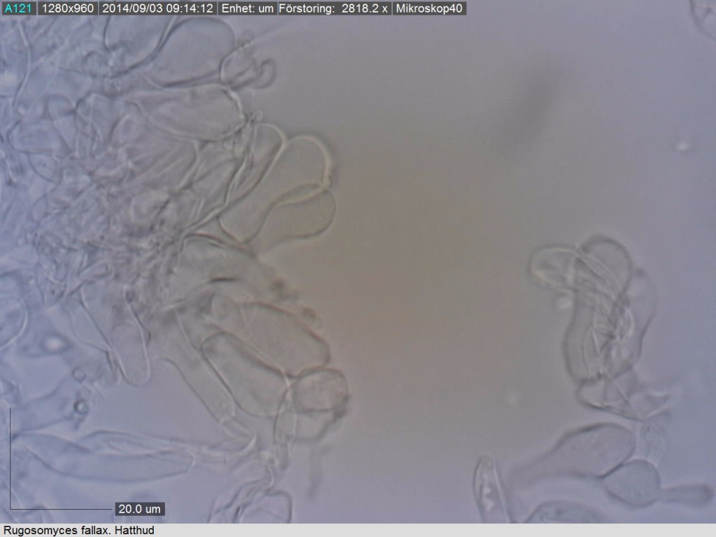 Den cellulära hatthuden är typisk för R. fallax. Brännmossen N 2/9 2014 Mikroskopi: Lars Bsenko