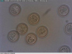 Helt släta och amyloida sporer hos slätsporig svedjeskål. Römossen S 9/12 2014. Mikroskopi: Lars Bsenko